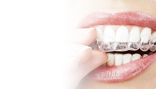 Cosmetic dentistry — teeth whitening